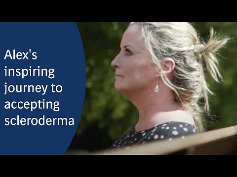 How is life with scleroderma?