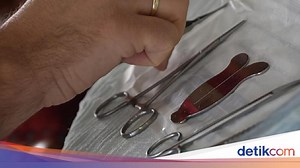 Sunat Perempuan Masih Marak Dilakukan, Ini 5 Risikonya Menurut Dokter