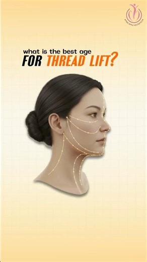 Should You Get a Thread Lift Now? Watch This Before Deciding!
