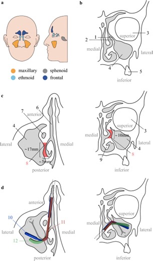 A miniature robotic steerable endoscope for maxillary sinus surgery called PliENT - Scientific Reports