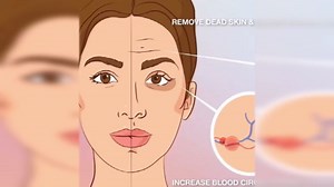 blackhead suction instrument