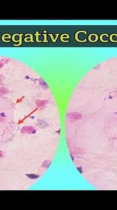 Gram Staining |BAL |Cytology |Gram Negative Coccobacilli |Fungal Staining| E-Learn withTechnologist