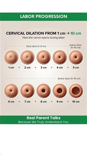 Cervical Dilation During Labor (1–10 cm)