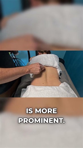 Understanding Scoliosis: Annika's Curve Explained