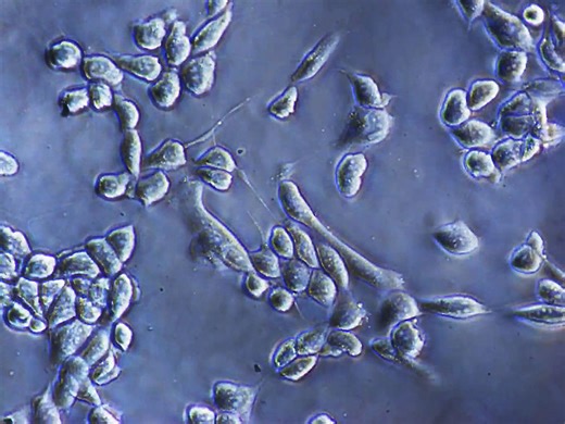 Researchers present novel, enzyme-free strategy for detaching cells from culture surfaces