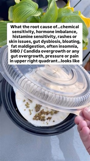 Kelsey | Holistic Health & Root-Cause Healing on Instagram: "Liver & gallbladder flushing does more than just expel built-up stones & sludge or even parasites…it helps bile flow return to normal 🥳 If bile flow is slow or bile is thick, the entire body slowly is brought to a halt. Overtime as we’re exposed to mold, chemicals & other toxins, our bile thickens. I know a 22 year old, otherwise previously healthy & very active who was recently diagnosed with liver sludge & a congested common bile du