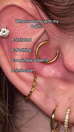 Understanding Conch and Daith Piercing Issues