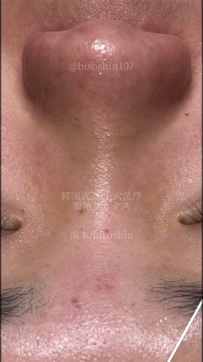 韓国式3D毛穴洗浄/潤艶ワックス