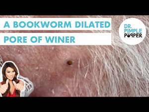 A Bookworm Dilated Pore of Winer
