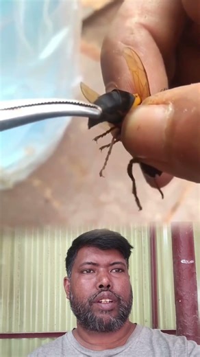 Bee Sting Removal and Care 🐝🩺