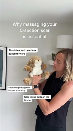 What happens to your body after a C-section