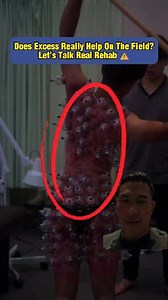 Cupping therapy can be a useful tool in rehab when applied with purpose. It may help improve local blood flow, reduce temporary pain, and increase short-term tissue mobility for certain athletes. But let’s be honest—cupping is often overused and overhyped, especially when sessions turn into excessive suction, stacked cups, and long-lasting marks. More cups and darker bruises do not equal better performance. Athletic success comes from movement re-education, progressive loading, strength developm