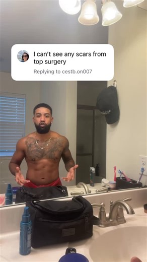 Brax Fleming on Instagram: "Surgery: Hemi-peri Double Masectomy Surgeon: Dr. Lo Where: Philadelphia, Pennsylvania Not everyone is a candidate for this type of surgery and it really just depends on what’s best for your body. ❤️ ✅ Shop @stealthbrosco"