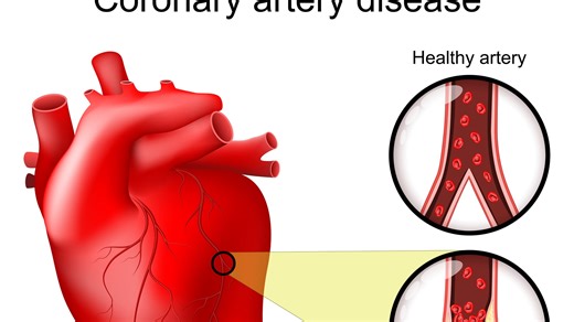 Did Taylor Swift's dad have a heart attack? What to know about quintuple bypass surgery