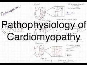 Pathophysiology of Cardiomyopathy