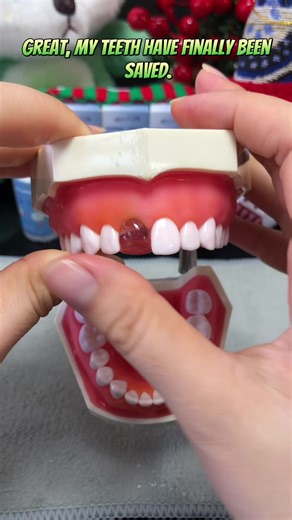 Temporary Dental Adhesive for At-Home Tooth Repair