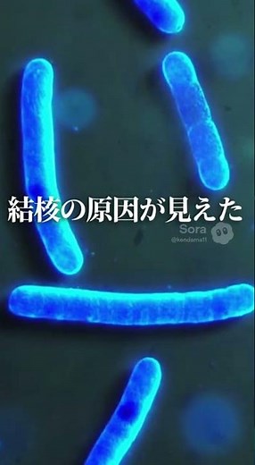 【1882年3月24日 | 結核菌発見｜ロベルト・コッホが暴いた“死の病”の正体