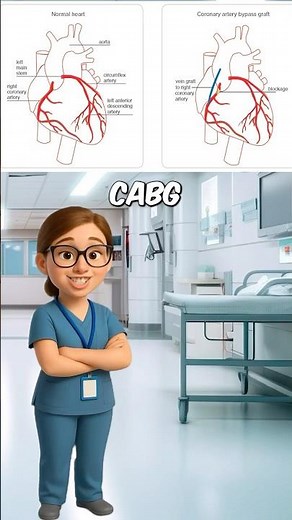 Heart Bypass Surgery Explained in 60 Seconds (CABG)