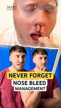 Easily remember epistaxis management