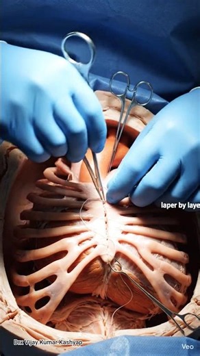 Open-Heart Surgery Explained | Inside a Cardiac Operation in 3D #health #medical #trending #india