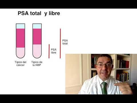 PSA ¿Qué VALORES indican un posible CÁNCER de próstata? | Descifrando analíticas | Medicina Clara
