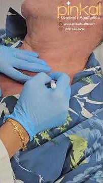 Seborrheic Keratosis Treatment & Removal using Liquid Nitrogen