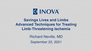 Vascular surgeons at Inova Heart and Vascular Institute (IHVI) provide a full range of treatment options for peripheral arterial disease (PAD), a slow and progressive circulation disorder that can restrict the flow of oxygen-rich blood to the arms and legs. To learn more, watch our recent webinar with Richard Neville, MD, Associate Director of IHVI, System Division Chief of Vascular Surgery and Chairman of the Department of Surgery. #PAD #inovaheartandvascularinstitute | Inova