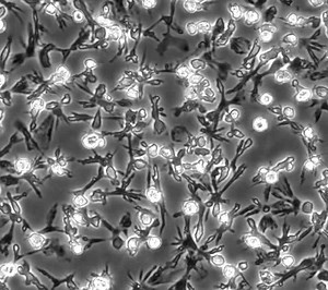 File:Fluid-Phase-Pinocytosis-of-Native-Low-Density-Lipoprotein-Promotes-Murine-M-CSF-Differentiated-pone.0058054.s019.ogv - Wikimedia Commons