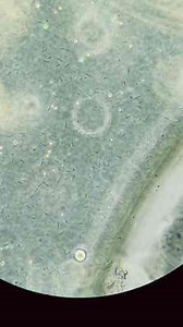 Examining Spoiled Food Under a Microscope