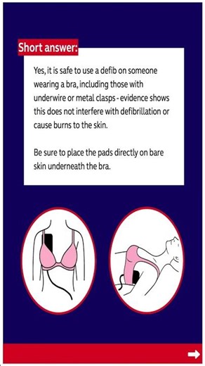 MUST KNOW! AED Pads on Someone Wearing a Bra? Here’s What You Do #CPR #AED #Woman #ambulance #defib