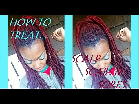How To Treat Your Scalp Sores and Scabs (for all hair types)