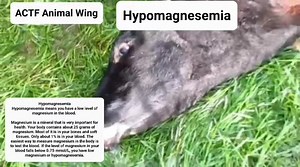 Hypomagnesemia What are the symptoms of hypomagnesemia? Tremors....