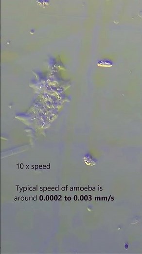 How Fast Does an Amoeba Move? 🧫 #Shorts #microscopy