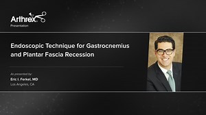 Endoscopic Technique for Gastrocnemius and Plantar Fascia Recession