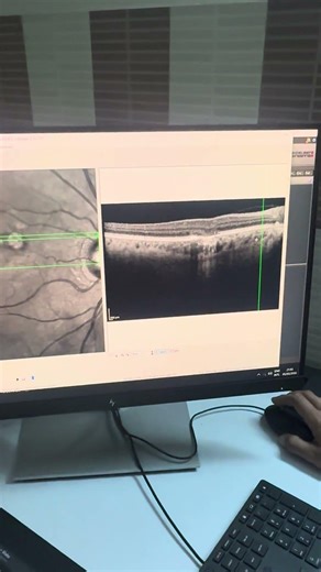 Retina Scan New Technology #eyes #eyescheckup #doctor #shorts