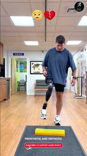 Man Walking & Cycling With His Prosthetic Leg — Artificial Leg Confidence & Freedom! #nevergiveup