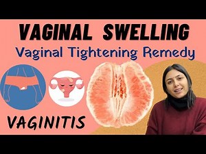 Vaginal Swelling Vaginitis Home Remedy | Vaginal Tightening | Vaginal Itching | Dr. Upasana Vohra