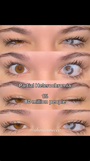 Types of Heterochromia you may have🩶✨ #shorts #glowup
