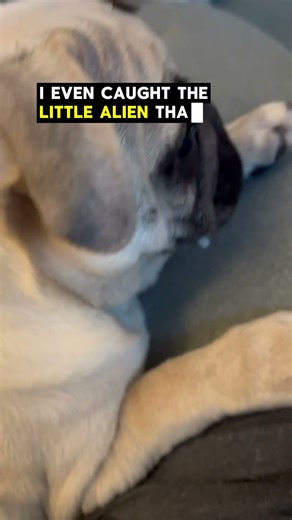 IVE BEEN IMPLANTED BY ALIENS 👽