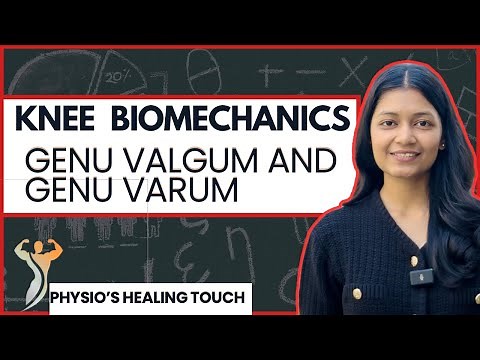 KNEE VALGUM & KNEE VARUM | KNEE BIOMECHANICS | PHYSIOTHERAPY
