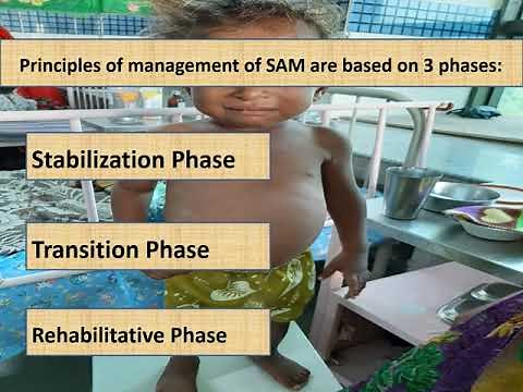 Severe Acute Malnutrition (Part 1/4) | Appetite test | Pediatrics