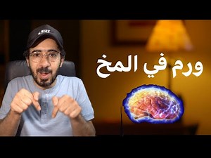 ورم في المخ