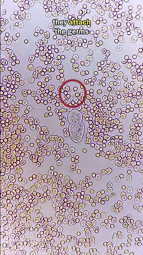 White Blood Cell Fights GIANT GERM!