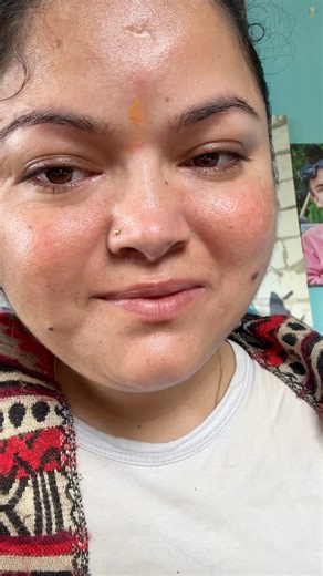 1.7M views · 72K reactions | मलाई धेरै गारो भो हस्पिटल जादै छु अही...