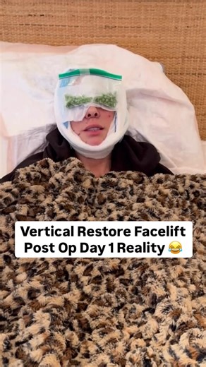 Amir M Karam, MD on Instagram: "Real Vertical Restore Recovery: Tami’s Day 1 Update 😂 This is what the first evening after facial rejuvenation surgery looks like. Tami is just 1 day post-op, applying frozen peas to her eyes to help manage swelling. She started feeling the tightness and fullness that naturally come in the first 24 to 48 hours. These early days of recovery are when patients often feel the most unsure. Swelling, bruising, and discomfort are part of the process. But Tami stayed gro