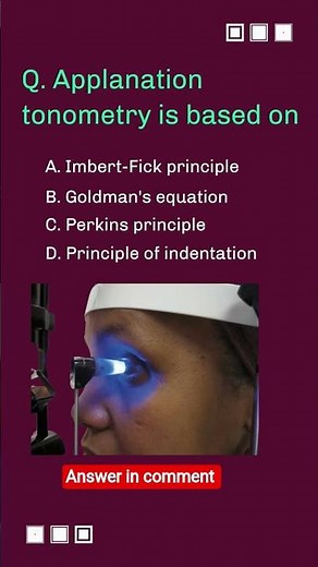 Applanation tonometry is based on...