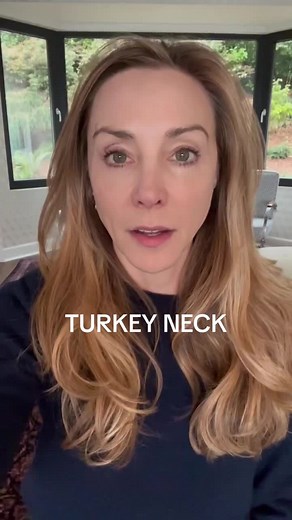 I get a lot of question about how to treat “turkey neck”- here are some things you can do! #turkeyneck #botox #filler #skincare #antiagingtips #dermatologist #seattledermatologist