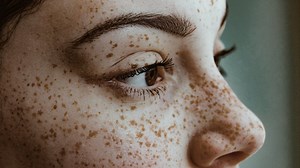 What is Face Blindness?