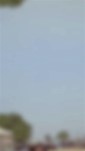 The Truth Behind BBL and Body Transformation