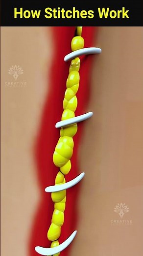 How wound stitches really work #shorts #facts - Creativelearning3d